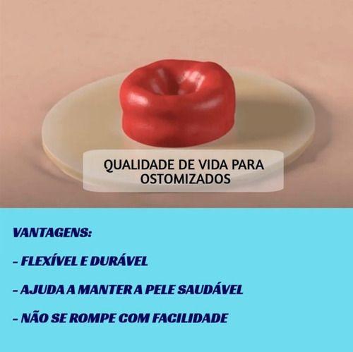 Imagem de Brava Anel Moldável Para Colostomia 4,2mm Coloplast 5 Unidades