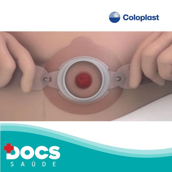 Imagem de Brava Cinto de Ostomia Coloplast 0421 KIT 05 unidades