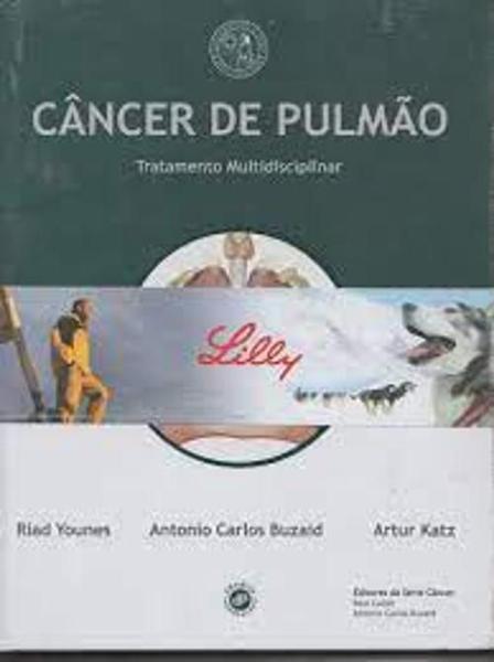 Imagem de Cancer de pulmao: tratamento multidisciplinar - DENDRIX