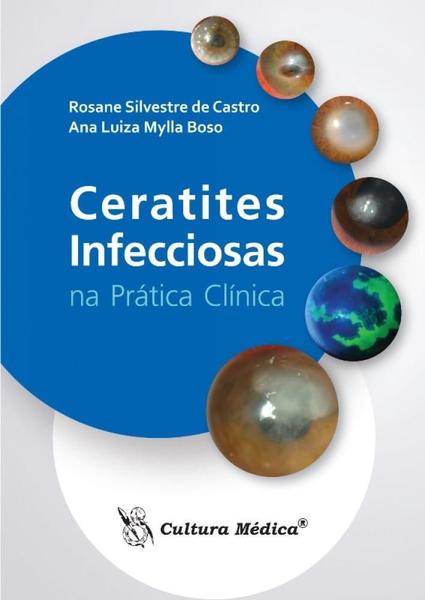 Imagem de Ceratites infecciosas na pratica clinica