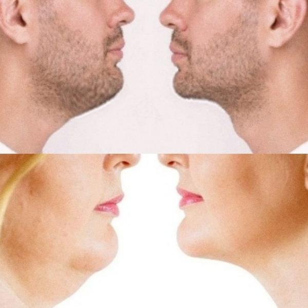 Imagem de Cinta Facial Pós Bichectomia E Procedimentos Estéticos em Geral