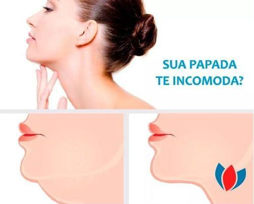 Imagem de Cinta Faixa Facial Pós Bichectomia - M02