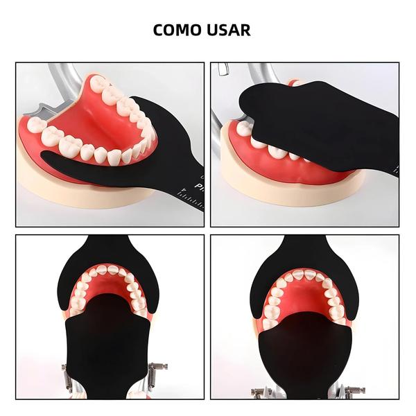 Imagem de Conjunto de 4 Espelhos Intraorais Autoclaváveis com Fundo Preto - Contraste Dental