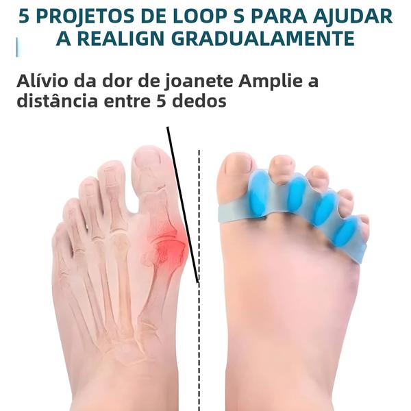 Imagem de Corretor De Joanete Maca De Dedo Do Pé Espaçadores De Gel Macio Alívio Terapêutico Para Fascite