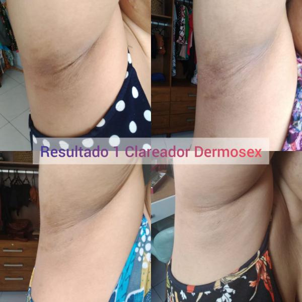 Imagem de Creme Clareador Dermosex e Lubrificante Hidrata Neutro MIVS