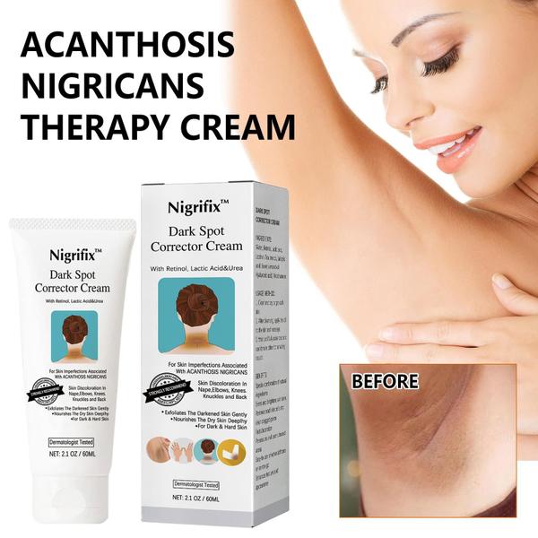 Imagem de Creme Nigrifix Acanthosis Nigricans Therapy Dark Spot 60mL