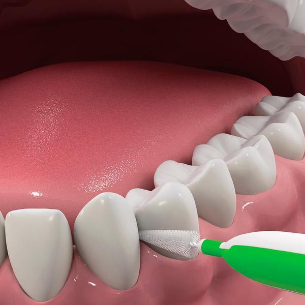 Imagem de Dentek Interdental Easy Brush Tight Espaços Apertados 16 Un