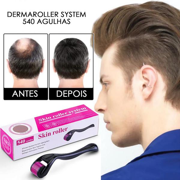 Imagem de Dermaroller 540 Agulhas Derma Roller Anti Rugas 25mm