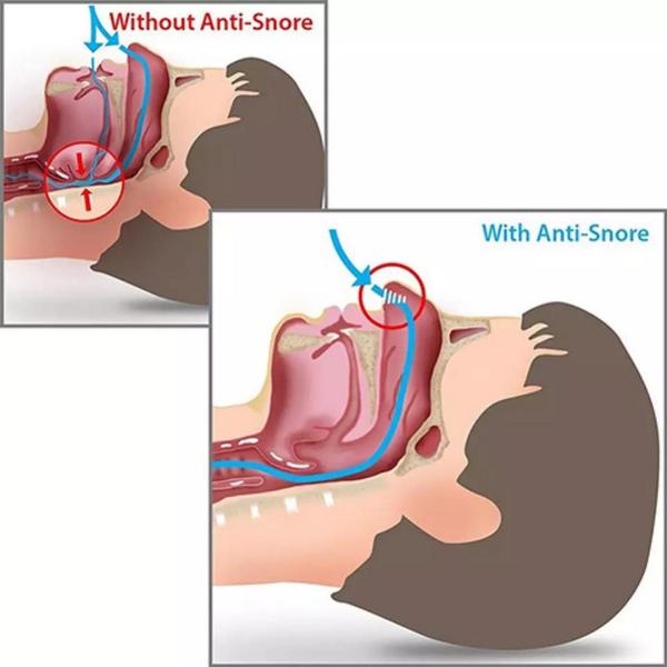 Imagem de Dilatador Nasal Anti Ronco E Apnéia Do Sono Filtro