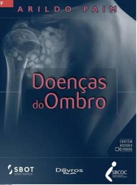 Imagem de Doencas do ombro - Di Livros Editora Ltda