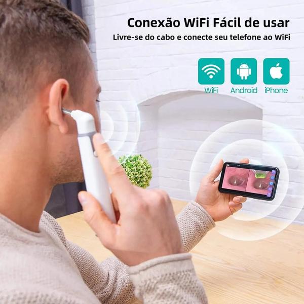 Imagem de Endoscópio de Orelha Sem Fio 3.9mm 720p HD WiFi - Otoscópio com 6 LEDs para Crianças