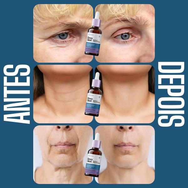 Envy Skin Zencial Sérum Facial com Retinol Niacinamida Firmeza