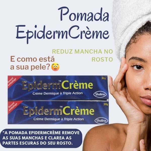 Imagem de Epiderme Pomada Tira Manchas 15g