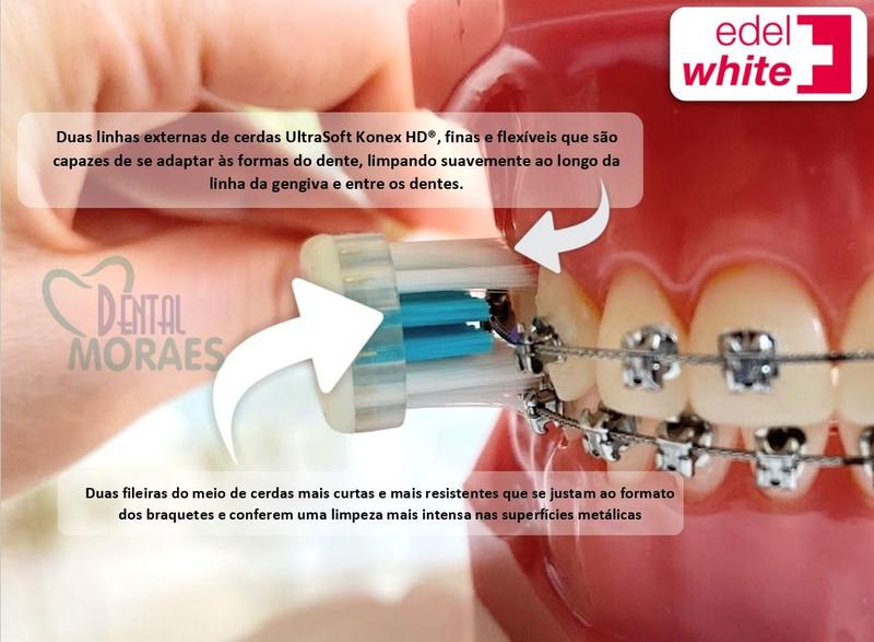 Imagem de Escova de dentes ortodôntica pro ortho for braces edel white