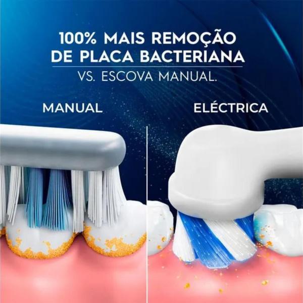 Imagem de Escova Dental Elétrica Pro Series 1 - Oral-B