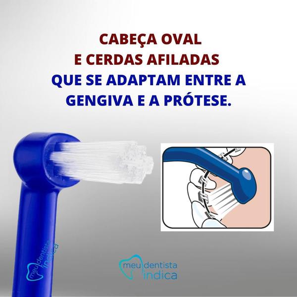 Imagem de Escova Dental Universal Care  Tepe  Ideal p/ implantes  3 unidades