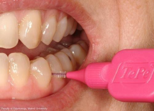 Imagem de Escova Interdental Limpa Implante  0,45mm C/6 Unidade