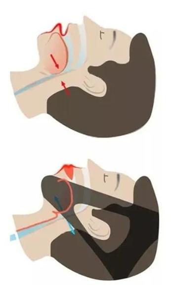 Imagem de Faixa Anti Ronco Queixeira Cinta Queixo Elástica Unissex