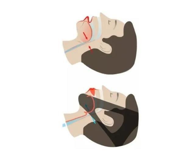 Imagem de Faixa Mandibular Dortler Ajustável Elástica Compressão Ronco