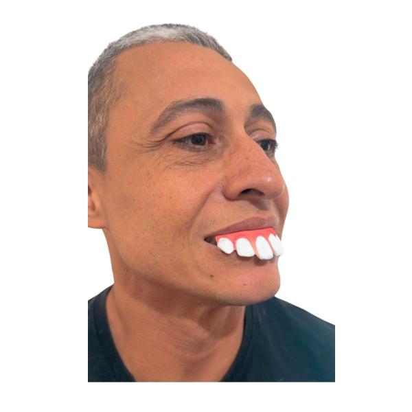 Imagem de Fantasia Dentão Dente Ronaldinho Engraçado Cosplay Carnaval