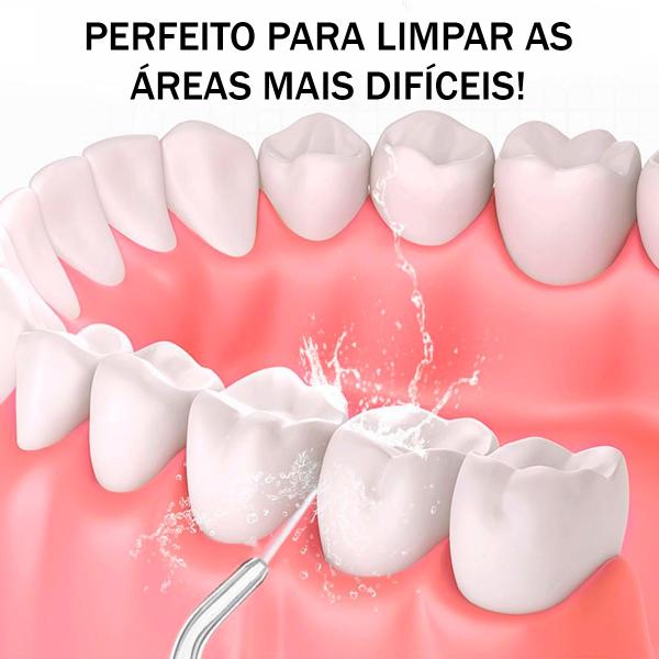 Imagem de Higienizador Oral Portátil Para Limpeza Profunda De Dentes, Gengiva e Aparelhos