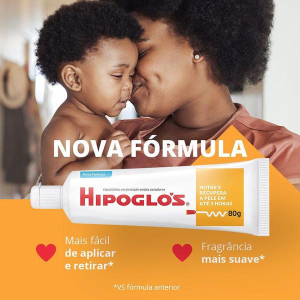 Imagem de Hipoglos Amêndoas Pomada Contra Assaduras 80g