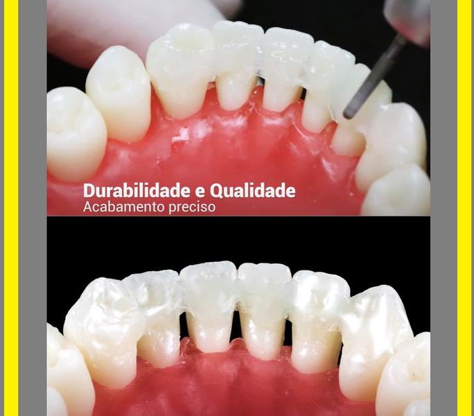 Imagem de Interlig Fibra De Vidro Trançada C/3 Angelus