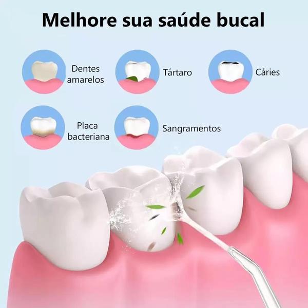 Imagem de Irrigador Bucal Elétrico Portatil Limpeza Profunda Jato Água Limpador Dentário