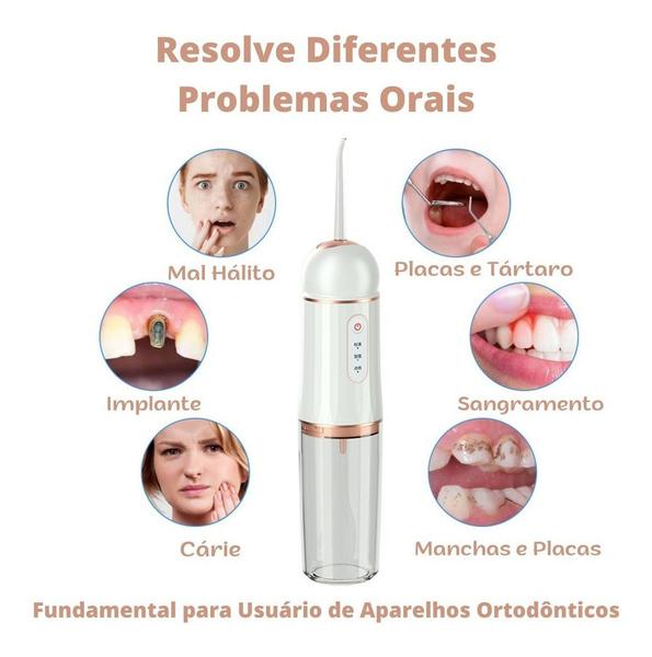 Imagem de Irrigador Bucal Jato Fio Oral Limpa Aparelho Dental Slu Med 