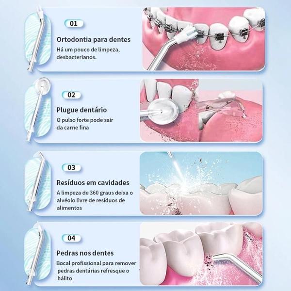 Imagem de Irrigador Higienizador Oral Jato D'Água Aparelho Bucal Dente