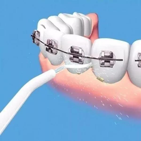 Imagem de Irrigador Jato De Agua Limpeza Oral Dental Bucal Power Floss