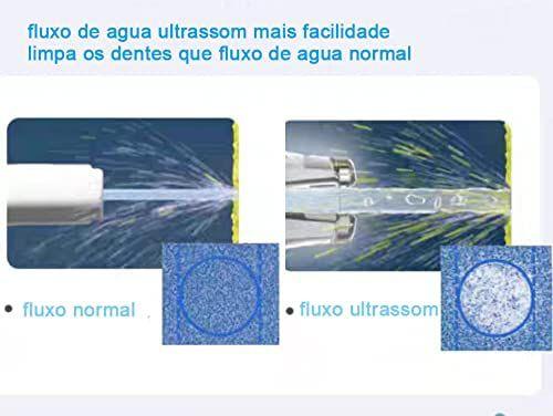 Imagem de Irrigador Oral Bucal Elétrico Recarregável Limpeza Profunda e Completa Higiene Bucal Rápido e Eficaz Rosa