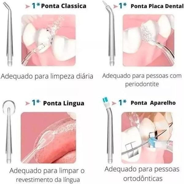 Imagem de Irrigador Oral com Jato d'Água para limpeza ideal!