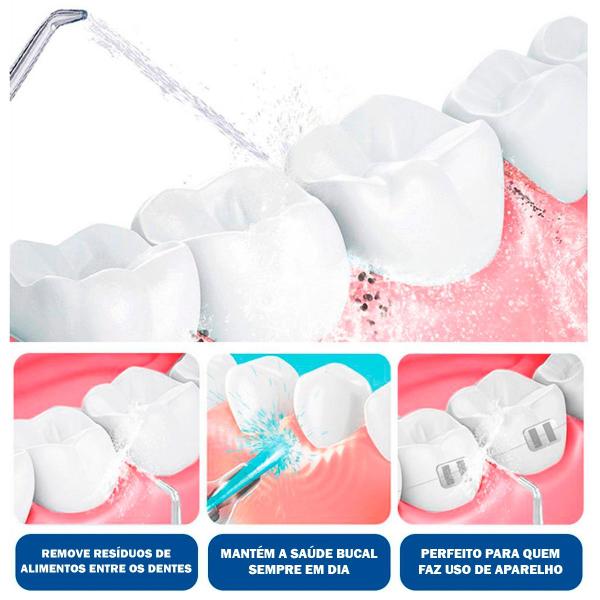 Irrigador Oral Dental Elétrico Bivolt Limpeza de Gengiva Dente e Implante - BELLATOR Imagem de Irrigador Oral Dental Elétrico Bivolt Limpeza de Gengiva Dente e Implante