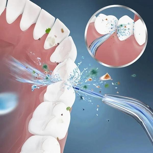 Imagem de Irrigador Oral Elétrico Jato D'Água Limpador Dental E Bucal