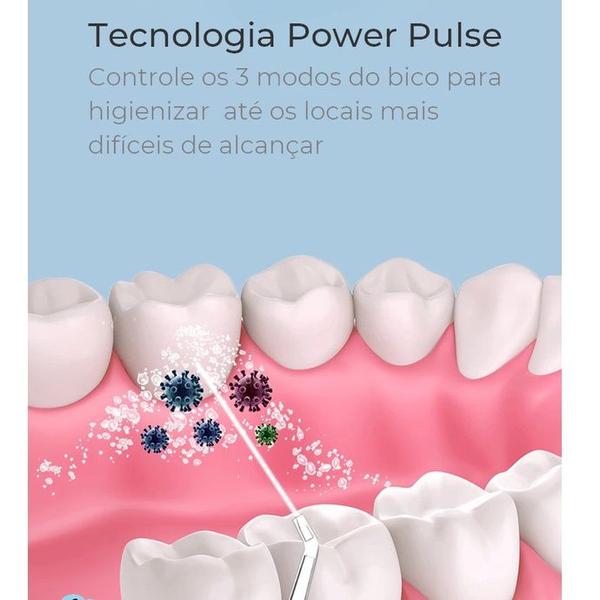 Imagem de Irrigador Oral Elétrico Portátil Jato Água Limpador Bucal