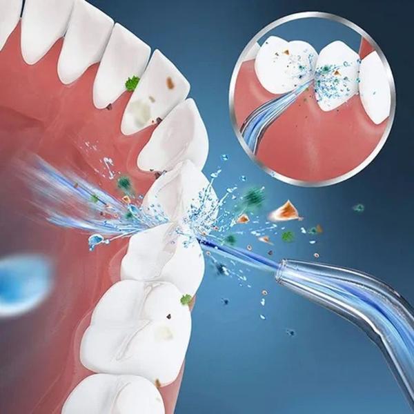 Imagem de Irrigador Oral Elétrico Portatil Jato Água Limpador Dentário Bucal