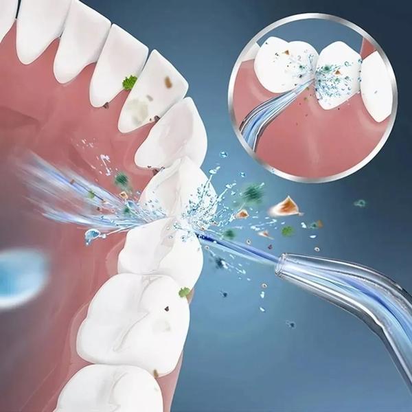 Imagem de Irrigador Oral Elétrico Portátil Jato Água Limpador Dentário Bucal