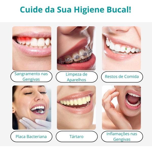 Imagem de Irrigador Oral Jato Agua Higiene Bucal Limpeza Dental 2025