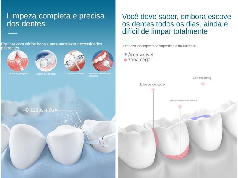 Imagem de Irrigador Oral Para Implantes Dentarios Higiene Bucal Prótese Dentária Com Certificado CCE/FCC D52 White