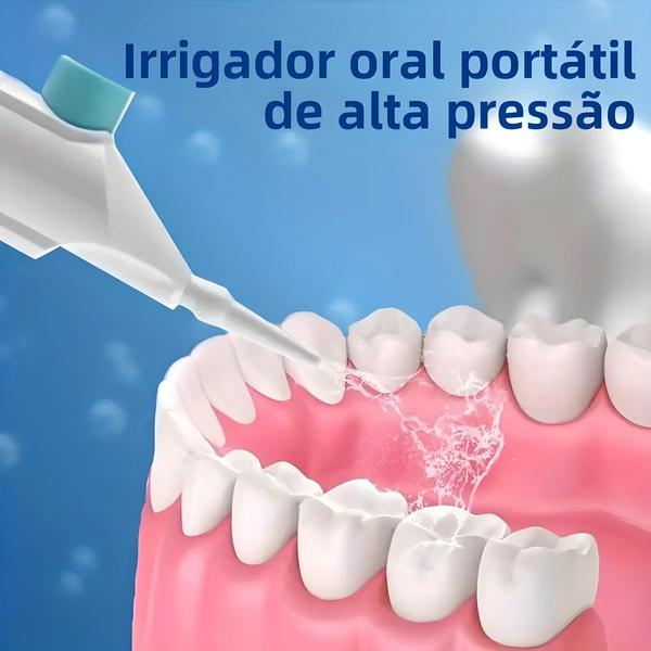 Imagem de Irrigador Oral Portátil de Alta Pressão - Fio Dental de Água para Limpeza Doméstica