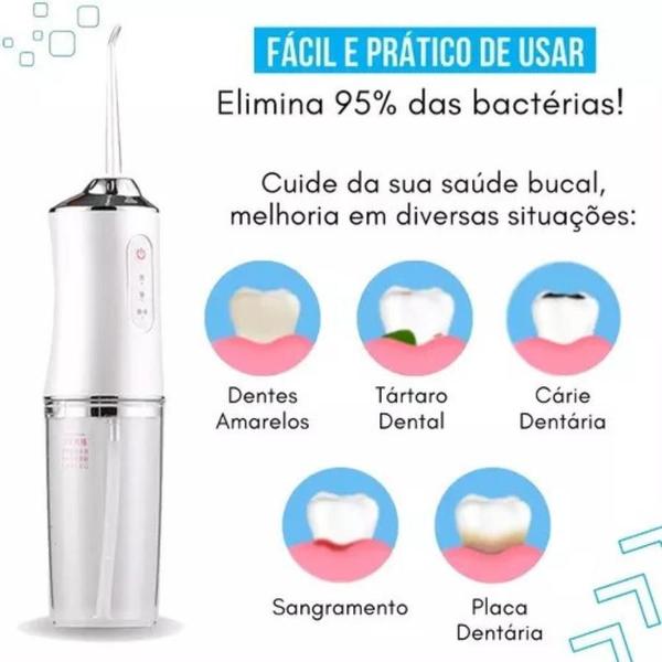 Imagem de Irrigador Oral Profissional: Tecnologia Avançada Sua Saúde