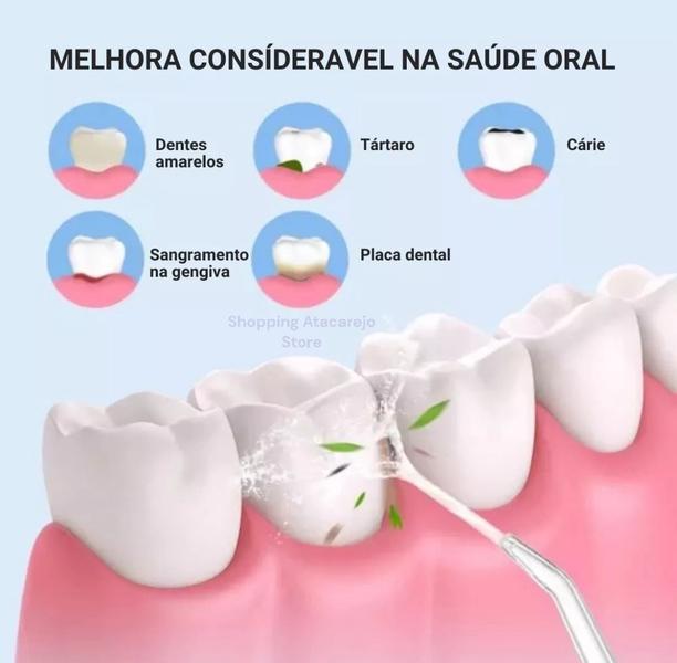 Imagem de Jato D'água Irrigador Oral Higiene Limpeza Bucal E Dental Gengiva Portátil Recarregável  