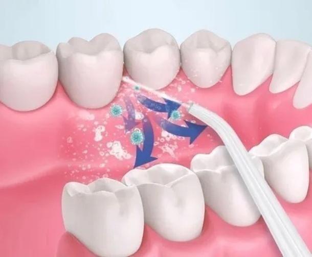 Imagem de Jato D'Água Irrigador Oral Higiene Limpeza Bucal E Dental