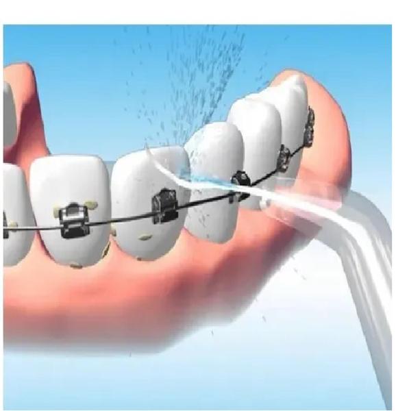 Imagem de Jato De Agua Oral Irrigador Limpeza dos Dentes Gengiva  Boca  portátil