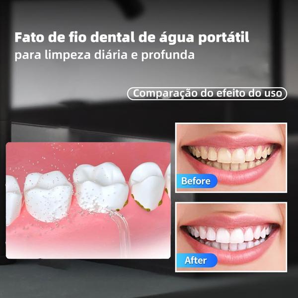 Imagem de Jato Limpeza Irrigador Bucal Dental Dentes Gengival Portátil Tela de Exibição Recarregável USB 6 modos 4 bicos Digital