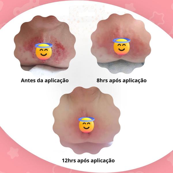 Imagem de kit 02 Spray Óleo Proteção Antiassaduras Assadura bumbum de anjo baby Ozônio Copaíba Lavanda