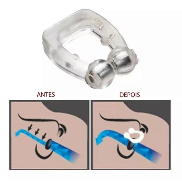 Imagem de Kit 2 Clipes Dilatador Nasal Anti Ronco E Apnéia Magnético Silicone - Pare de Roncar