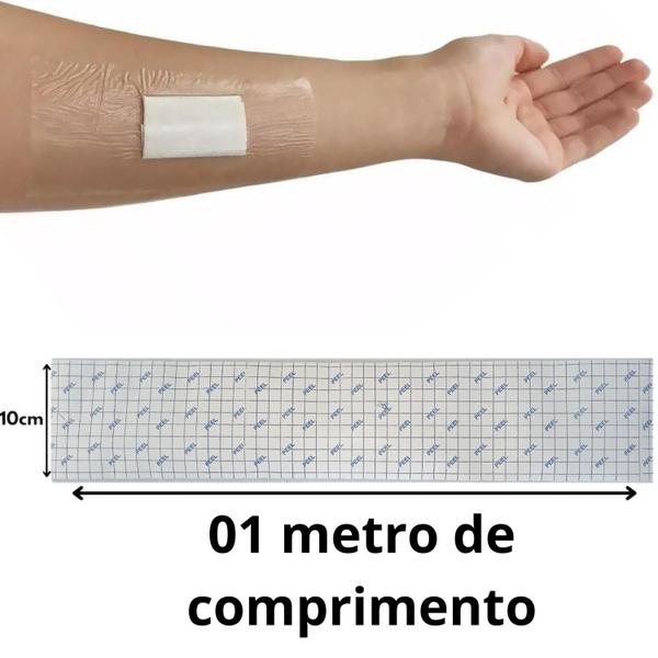 Imagem de Kit 4 Curativo Hidrocoloide + 1m Filme Adesivo Transparente Proteção Pele