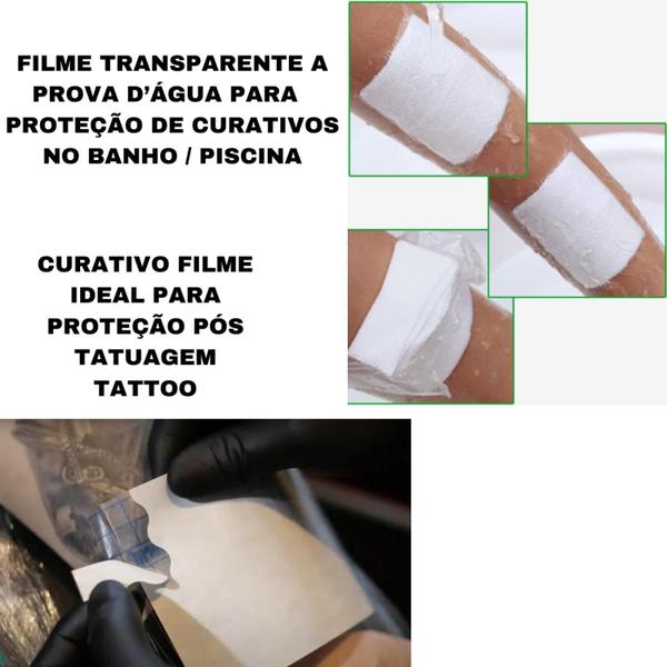 Imagem de Kit 4 Curativo Hidrocoloide + 1m Filme Adesivo Transparente Proteção Pele